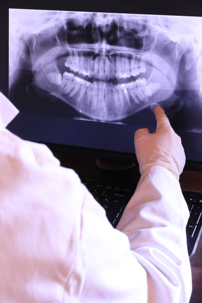Best Emergency Tooth Extraction in Tomah, WI