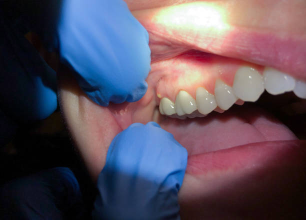 Best Pediatric Emergency Dentist in Tomah, WI